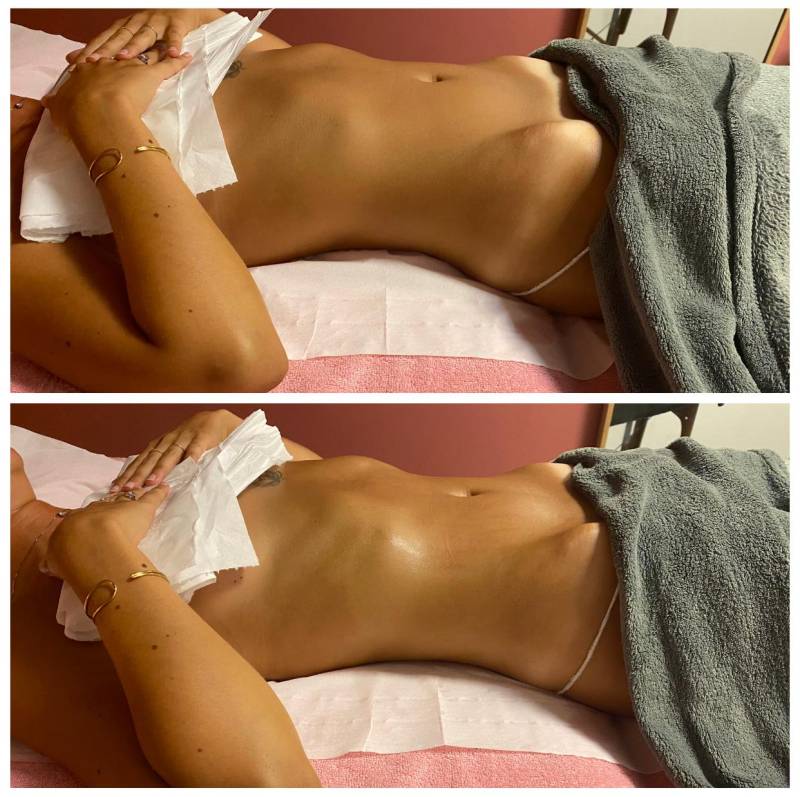 Massage drainant à Marseille